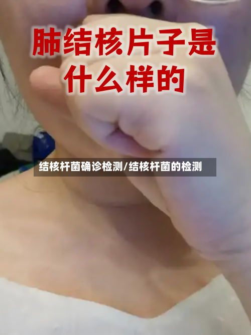 结核杆菌确诊检测/结核杆菌的检测