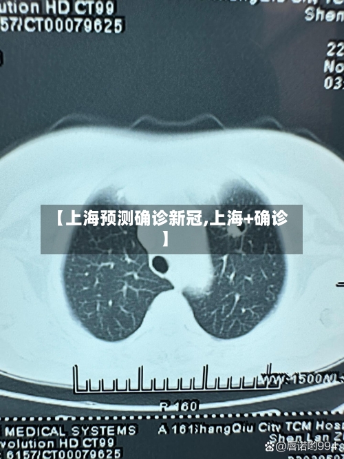 【上海预测确诊新冠,上海+确诊】