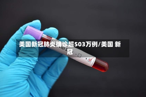 美国新冠肺炎确诊超503万例/美国 新冠