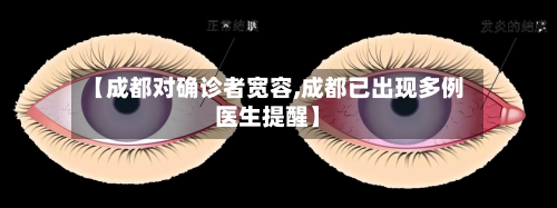 【成都对确诊者宽容,成都已出现多例医生提醒】