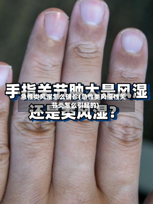 急性类风湿怎么确诊(急性类风湿性关节炎怎么引起的)