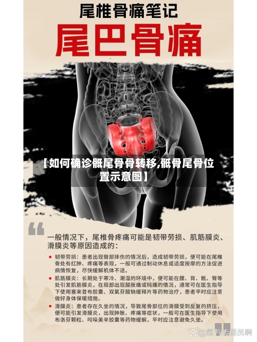 【如何确诊骶尾骨骨转移,骶骨尾骨位置示意图】