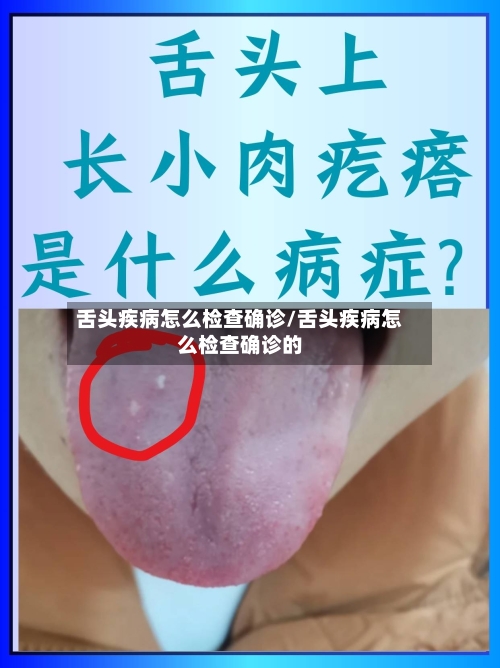舌头疾病怎么检查确诊/舌头疾病怎么检查确诊的
