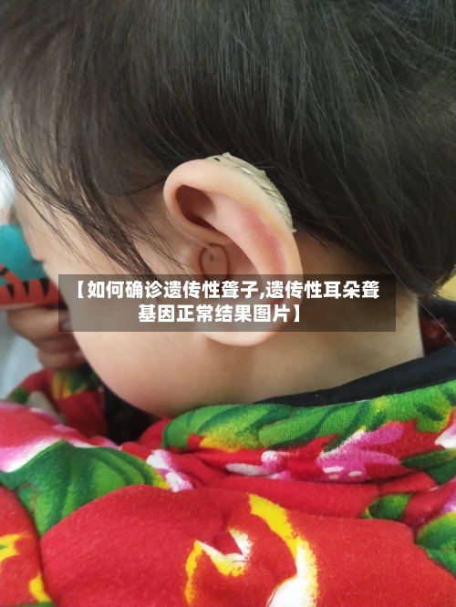 【如何确诊遗传性聋子,遗传性耳朵聋基因正常结果图片】