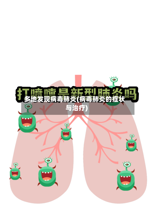 多地发现病毒肺炎(病毒肺炎的症状与治疗)